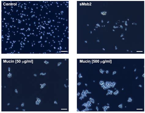 Candida albicans Shed Msb2 and Host Mucins Affect the Candidacidal ...