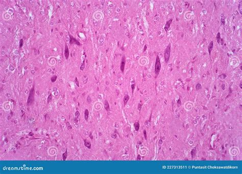 Neurons And Nervous System In The Human Brain. Histology Of Human Brain ...