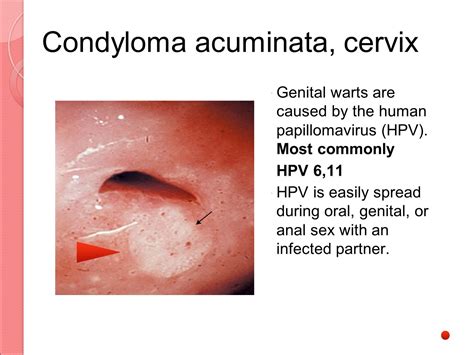 Ateneo School of Medicine and Public Health 16 November ppt video ...