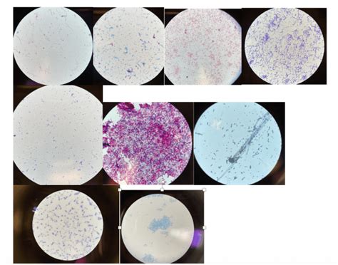 Image result for How to Use Microscope for Identification
