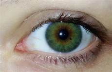 dunkle punkte im dunkler punkt im auge was ist das bild augen punkte dunkle punkte im dunkler punkt im auge was ist das bild augen punkte