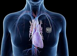 Image result for Cardiac