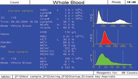 BC-2300 | 3-Diff Hematology Systems| Mindray India - Mindray India