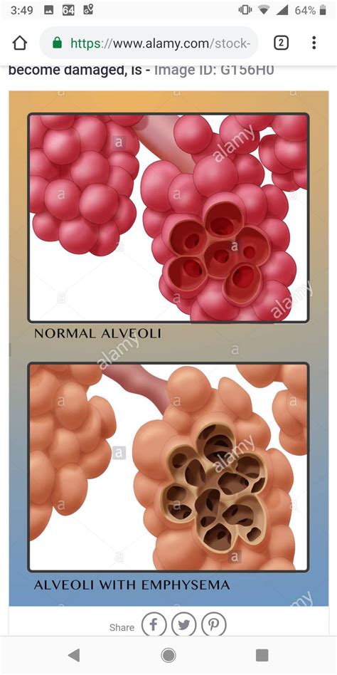 modeling - How to model blebs like structure as in lungs alveoli? - Blender Stack Exchange