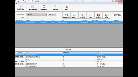 Image result for Epic Beaker Lab Module