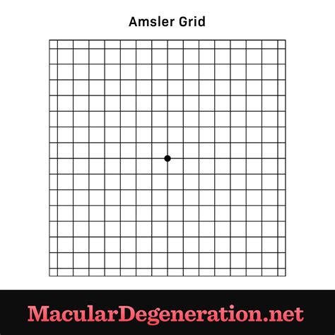 Printable Amsler Grid