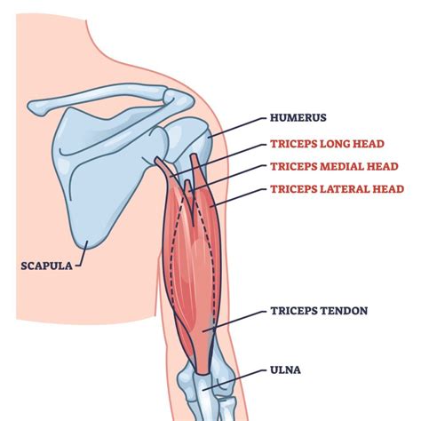 Triceps Tendon Tear - Los Angeles, CA - Dr. Jason Snibbe