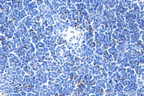 Foxp3 antibody (65089-1-Ig) | Proteintech