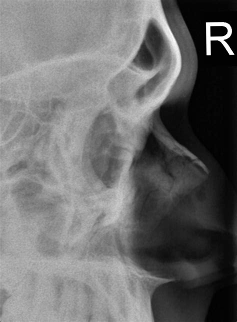 Image result for Scanner Cerebral Avec Injection Diode