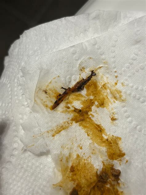 Mucus or worm in stool? : r/Parasitology