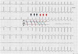 ECG 的图像结果