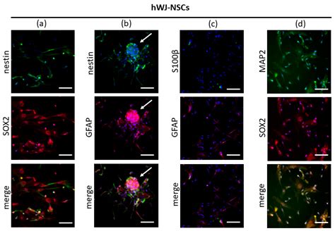 Differentiation of Human Mesenchymal Stem Cells from Wharton’s Jelly ...