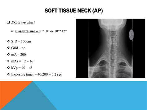 Soft tissue neck (upper airway) radiography | PPTX