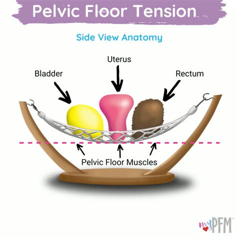 Pelvic Floor Tension