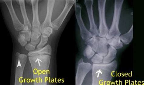Image result for Appendix with Screen Shot Example