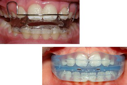 Dentists in Facevalue Dental & Smile Clinic Thodupuzha