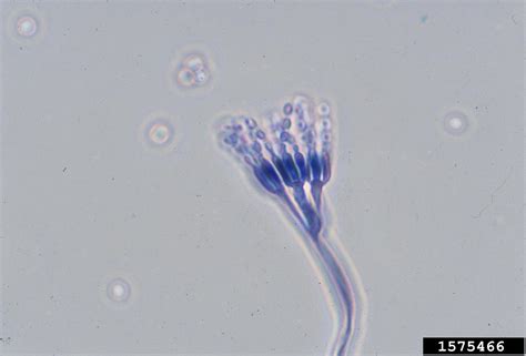 Diagrama De Penicillium
