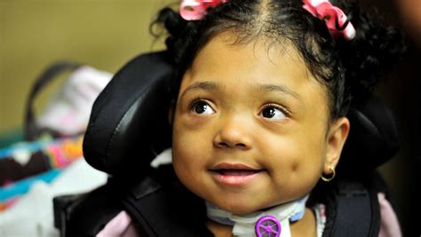 Baby Born Without Bones