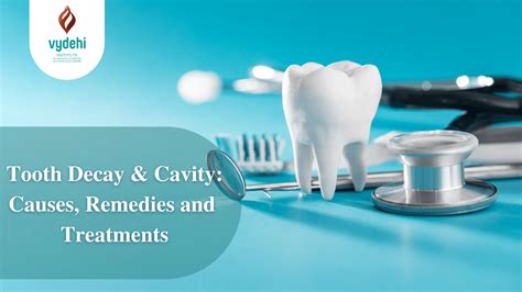Tooth Decay & Cavity – Causes, Remedies and Treatments