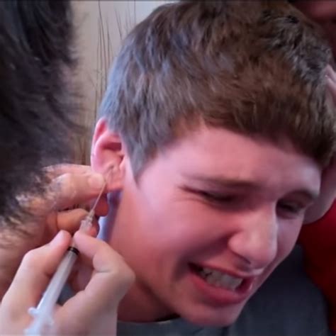 Kuvatulokset haulle cauliflower ear