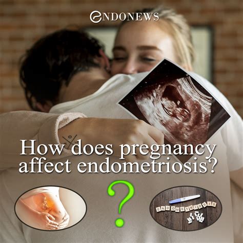 How does pregnancy affect endometriosis? | EndoNews