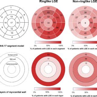 Image result for LGE Stat Tutorial
