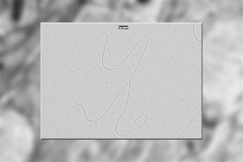 DNA Electron Microscope 的图像结果