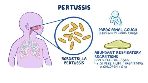 Video: Pertussis: Nursing
