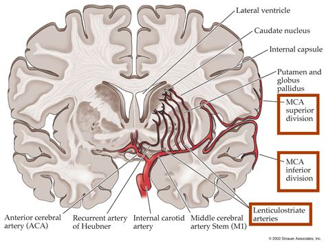 Middle Cerebral Artery (MCA) – Stepwards