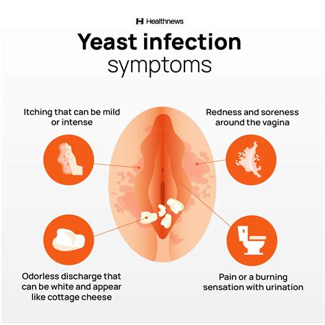 Female Yeast Infection Symptoms
