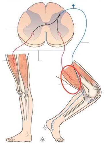 Image result for Crossed Extensor Reflex Demonstration