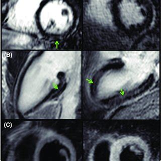 Image result for LGE Stat Tutorial