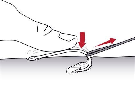 Image result for String Yank Method