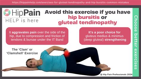 Exercises for Gluteal Tendinopathy and Hip Bursitis | Common mistakes