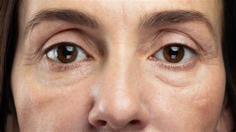 6 signs of protein deficiency that often go unnoticed