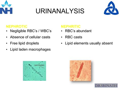 Nephritic vs nephrotic syndrome6npoqoa8qakc (1).pdf