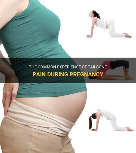 The Common Experience Of Tailbone Pain During Pregnancy | ShunChild