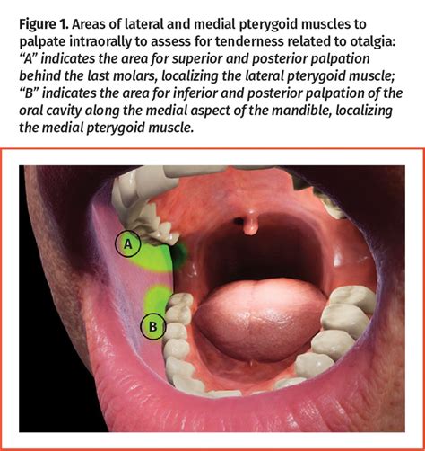 Referred otalgia | The College of Family Physicians of Canada