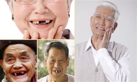 千人观摩长寿老人直播种牙_广州德伦口腔