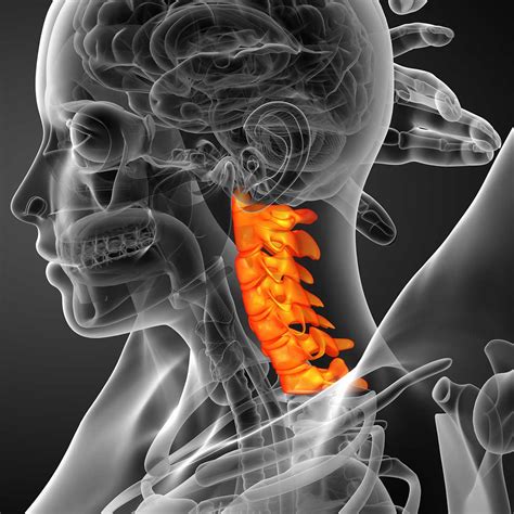 Straight Cervical Spine
