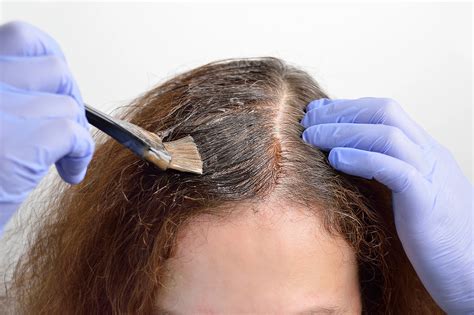 Can I Color My Hair After Mohs? | Dermatology and Skin Health - Dr. Mendese