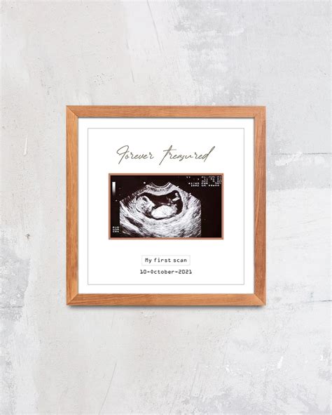 Baby Scan Frame - Giftmonk