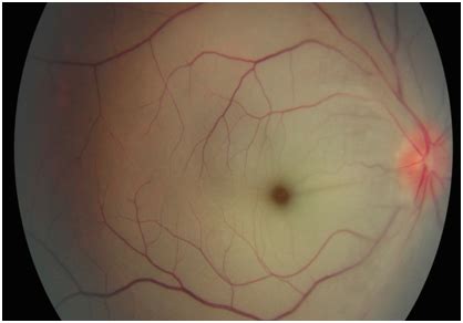 Department of Ophthalmology - Chettinad Academy