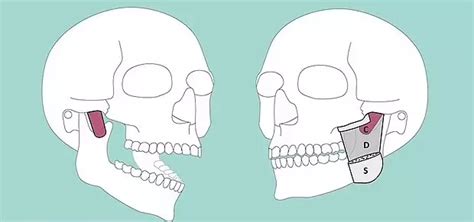 वैज्ञानिकों ने खोजी इंसानों के शरीर में नई मांसपेशी, निचले जबड़े में ...