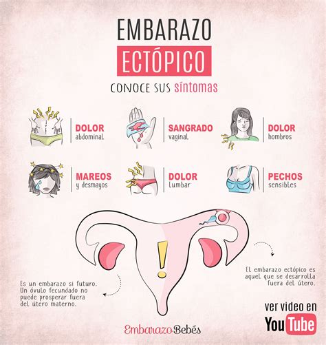 ⁣EMBARAZO ECTÓPICO⁣ | Embarazo ectopico, Síntomas de embarazo, Primeros ...