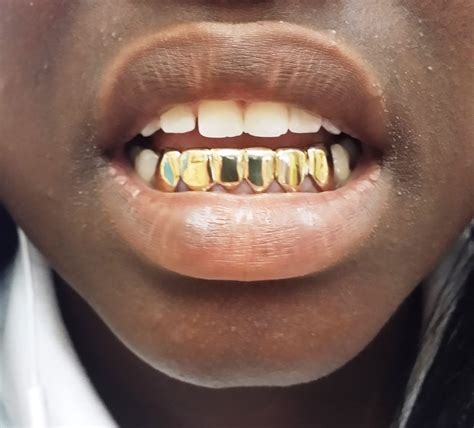 Gold Grillz Miami | Diamond grillz, Grillz, Gold teeth grillz