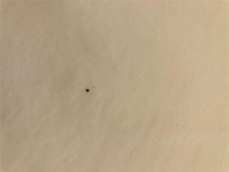 Black Spots On Sheets at Kathryn Peggy blog