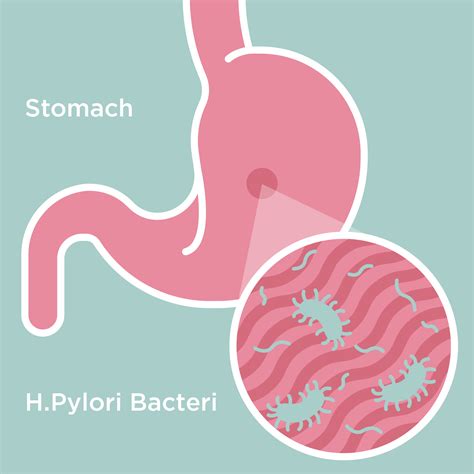 Does Boiling Water Kill H Pylori Bacteria at Larry Childs blog