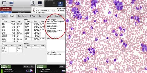 White Blood Cell Counts - Clinics in Laboratory Medicine