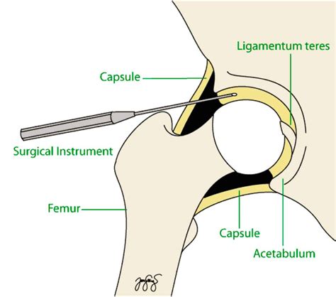 Ligament Of Teres